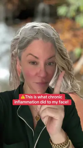 😱 I’ve been working to reduce the inflammation in my body, and apparently it’s paying off!! #turmeric #antiinflammatory #antiinflammatorydiet #chronicinflammation #naturalsupplements #healthtok #microingredients @Micro Ingredients #healthiswealth 