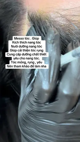 Tiêm Meso tóc, hay mesotherapy trị rụng tóc, là một phương pháp điều trị giúp kích thích mọc tóc, cải thiện tình trạng rụng tóc và nuôi dưỡng nang tóc. Kỹ thuật này giúp tăng cường lưu thông máu, cung cấp dưỡng chất thiết yếu cho nang tóc và ức chế hormone gây rụng tóc.  #nám_tàn_nhang_mụn_thâm #Hifuthanhhoá #mesotherapythanhhoá #nám_thanhhoa #hiifutreatmentthanhhóa #mesotherapythanhhoá 