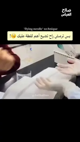 تكنيك الـFlying Needle 😧 أسرع تقنية سحب دم..مستخدمة من قبل الممرضين الصينيين: جربت هاي الطريقة من قبل لو أول مرة تسمع بيها؟ تعرف احد ماهر بالسحب ؟ 