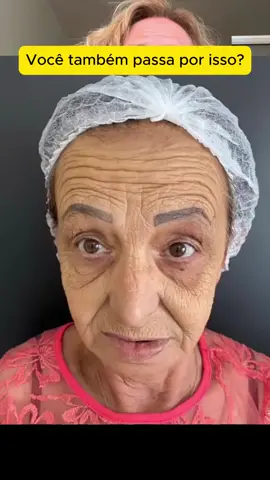 O site do tratamento está aqui na biografia! #envelhecimento #pelesaudavel #terceiraidade #dicasdebeleza #envelhecimentosaudavel #retinol #skincare #rugas #AllMyNamesWithAnchor 