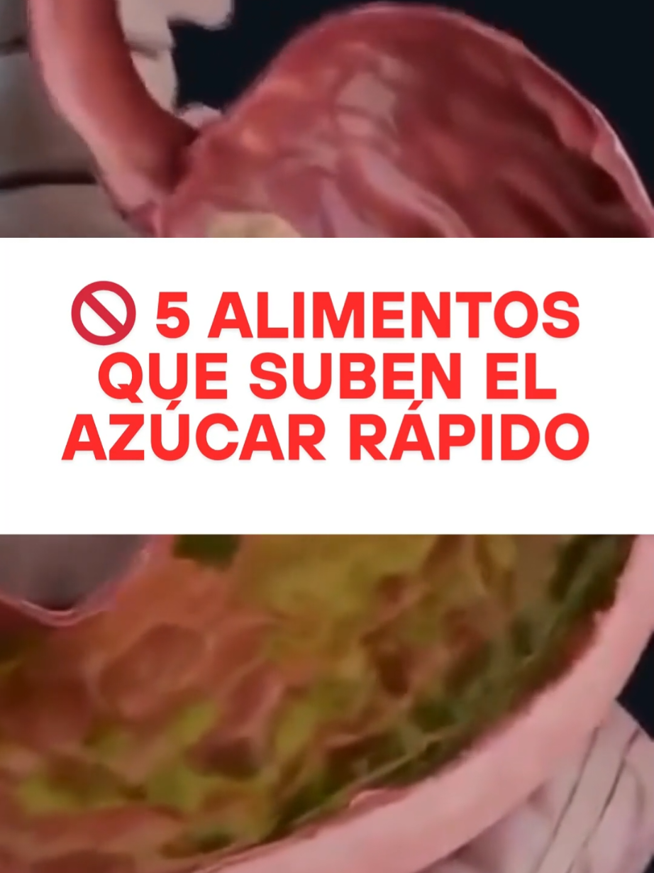 5 Foods That Raise Blood Sugar Quickly.#diabetes #peso #nutrition #tips #alimentacionsaludable 