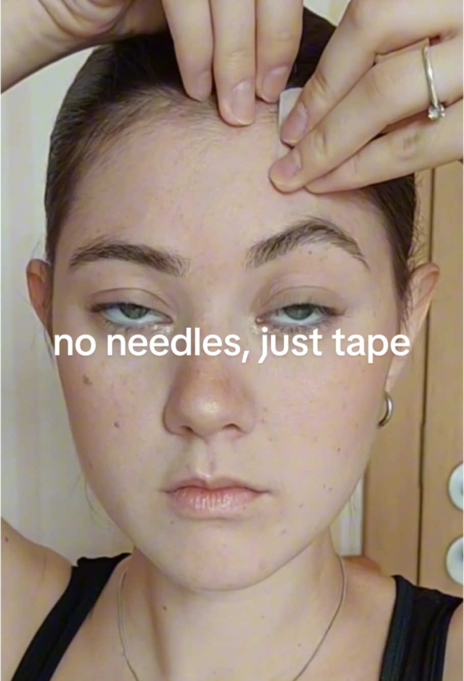 Check the result #nighttimeskincare #scartape #plumpskin #skincareroutine #beforeafter #facetape #faceslimming #facelifttape #girls 