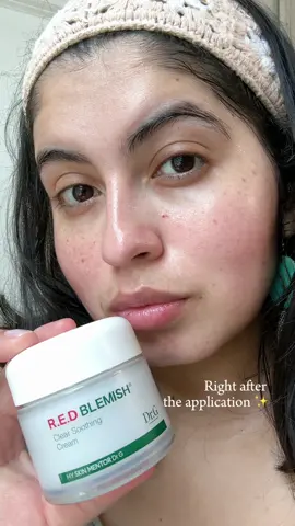 This is the Red Blemish Clear Soothing Korean Moisturizer Face Cream from @Dr. G 🌿 A cream composed of a variety of natural, cruelty-free, non-cosmetological plants that provide multiple benefits for different skin concerns, such as: - It's soothing. - It's hydrating. - It improves redness. - It has a light, easily absorbed texture. And as you can see, this is my second jar. This one is highly recommended! And it's available on #Amazon. Check my storefront, link in my bio! #soothing #glowingskin #DrG #RedBlemish #CicaCream #SkincareRoutine #sensitiveskin #KoreanSkincare #gifted #koreanbeauty #kbeauty #skincare #koreanskincare #koreancream #ugc #ugccontentcreation #makeup #calmingcream #vegan #rednesscream #tiktokshop #Junefinds #4ofjulysales #forsale