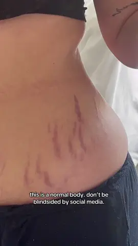 i grew a baby my body is beautiful. #postpartumbody #postpartum #realbody #stretchmarks #bodypositivity #fyp #foryou #foryoupage 