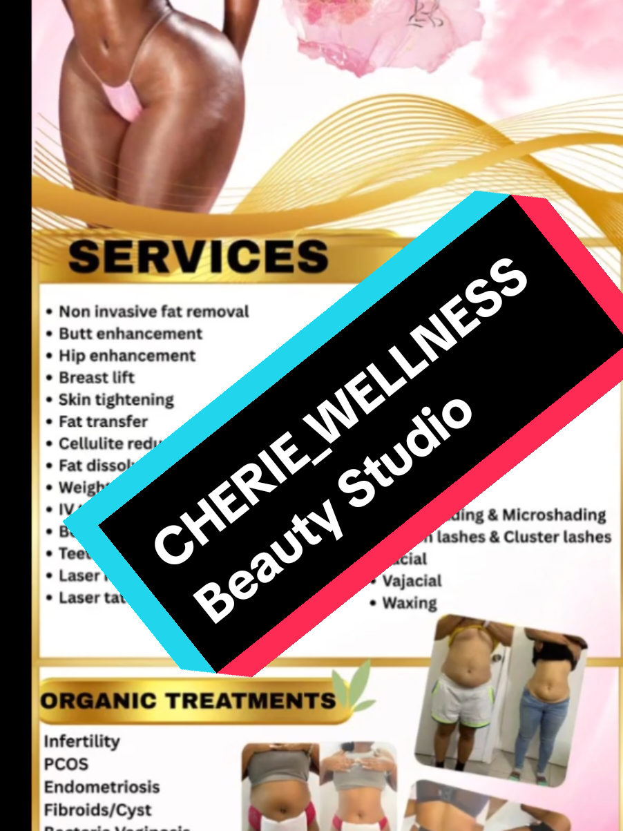 Replying to @queenpscollection1 She offers alot more services too! Message her for more information!  #cheriewellness #bellyfatremoval #bellyfat #nonsurgical @Cherie’s_wellness_beautystudio 