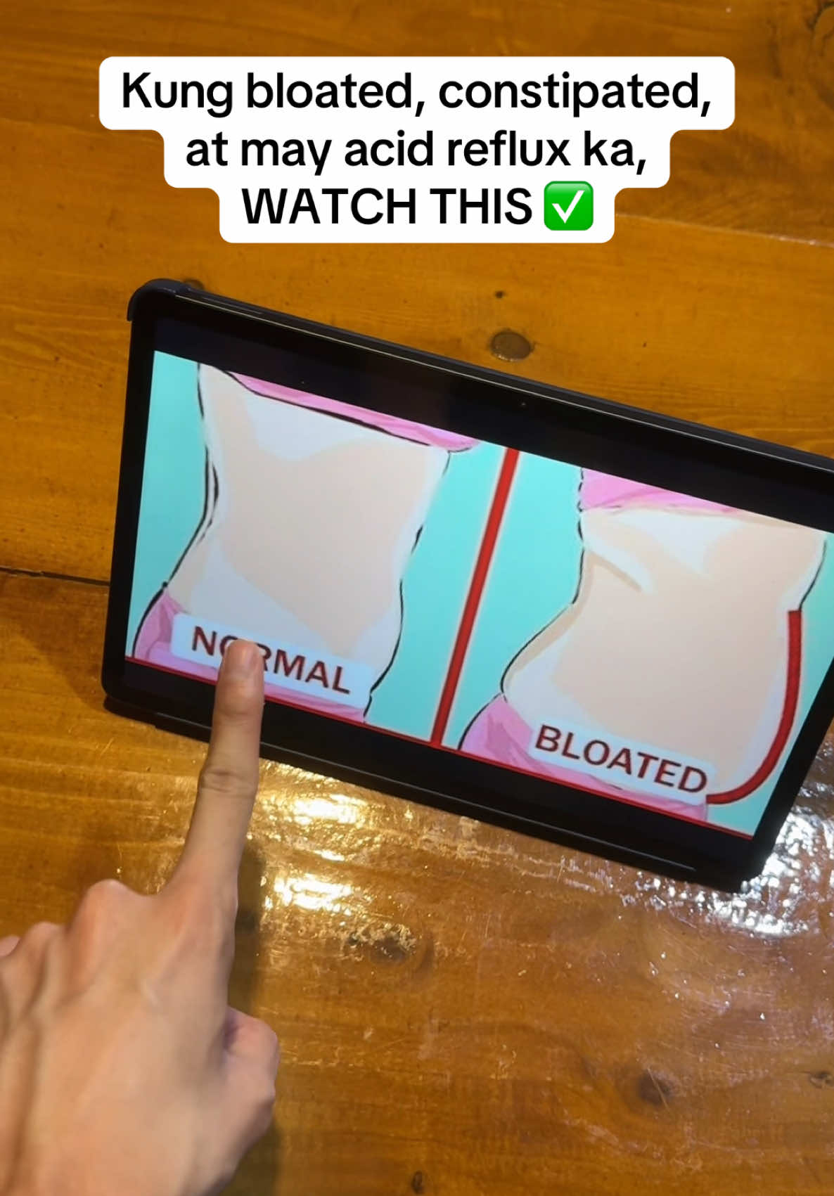 This is your sign to take care of your tummy or gut health, you can take this digestive aid to improve digestion and reduce bloating 🥰 #bloating #digestiveaid #guthealth #probiotics #dailyplus 
