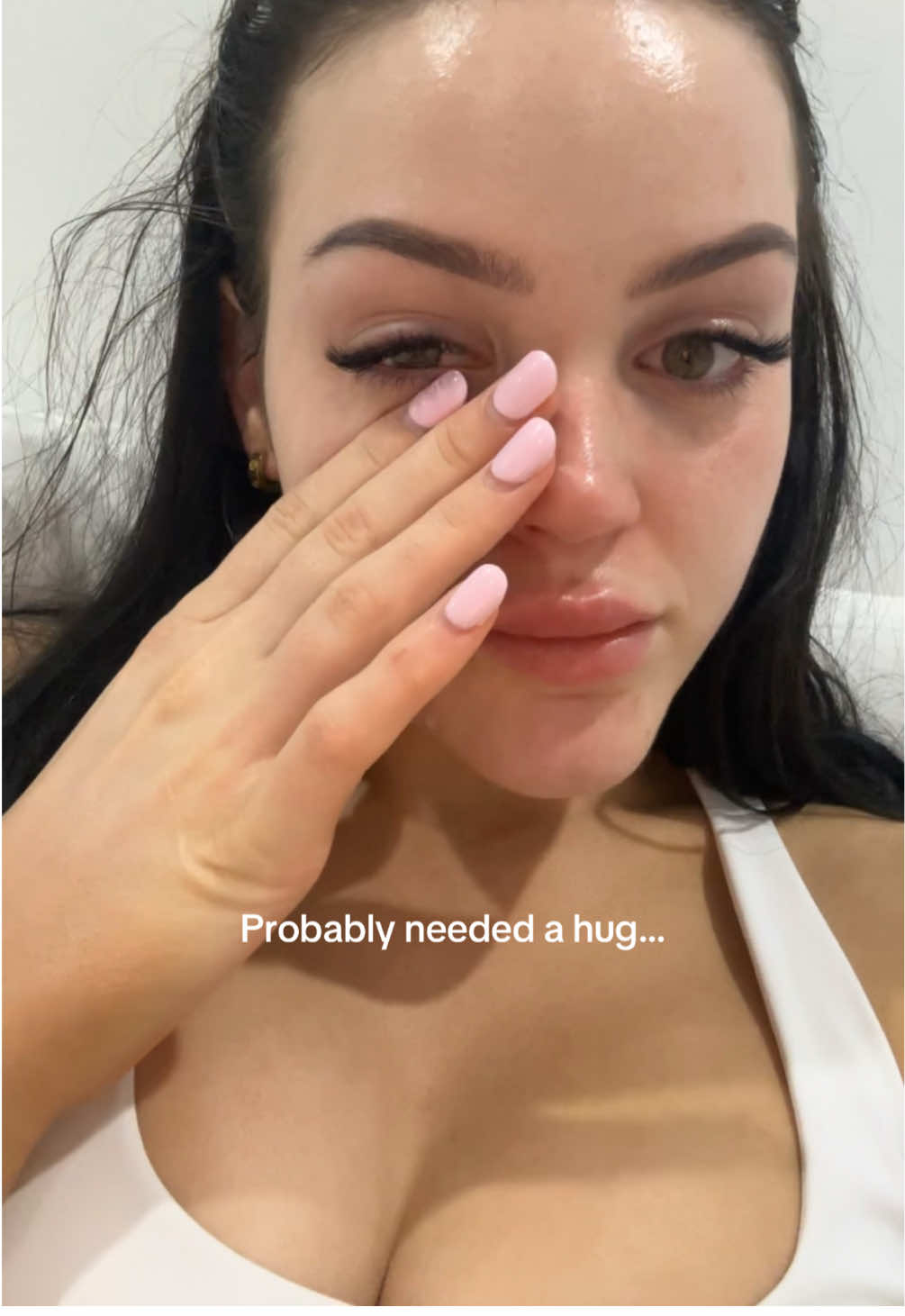 #trending #fyp #nosejob #perth #rhinoplasty 