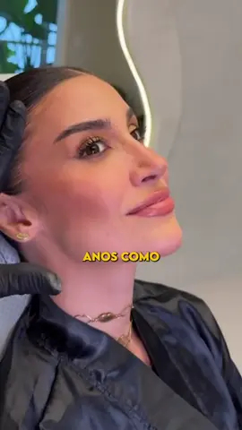 Você sabia que o botox pode ajudar a sua saúde mental? #botox #saudemental #saude