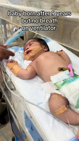 baby has no breath on ventilator support #ukraine🇺🇦 🇺🇸 #uktiktok 
