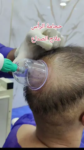 حجامة #حجامة_نبوية_بطريقه_علمية #المعالج_صلاح_الدليمي #العراق_السعوديه_الاردن_الخليج #بغداد_بصرة_موصل_الكويت_الخليج_دبي #مصر #امريكا #بمبش_السيد♦️bimbsh♦️مشاهير_التيك_تيك #مشاهير_تيك_توك 