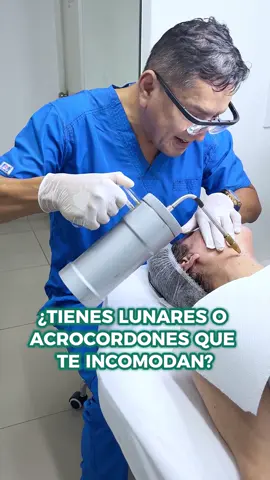 ✨ Láser CO2 fraccionado y crioterapia: elimina lunares y acrocordones con precisión, seguridad y resultados visibles. ✨ #dermatologia #medicinaestetica #esteticafacial #dermoestetica #laserco2 #lunares #acrocordones #crioterapia #limaperu🇵🇪 #peru🇵🇪 