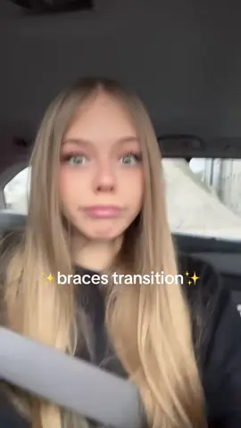 #braces #teen #blonde #young 