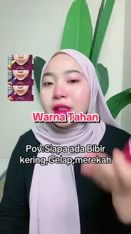 Barang sampai baru bayar #bibirhitam #bibirkering #bibirluka #bibirpecahpecah #bibirgelap #bibirpink #bibir #cikgumalaysia #surirumah #jururawatmalaysia #womanhubmalaysia #womanhubbeauty 