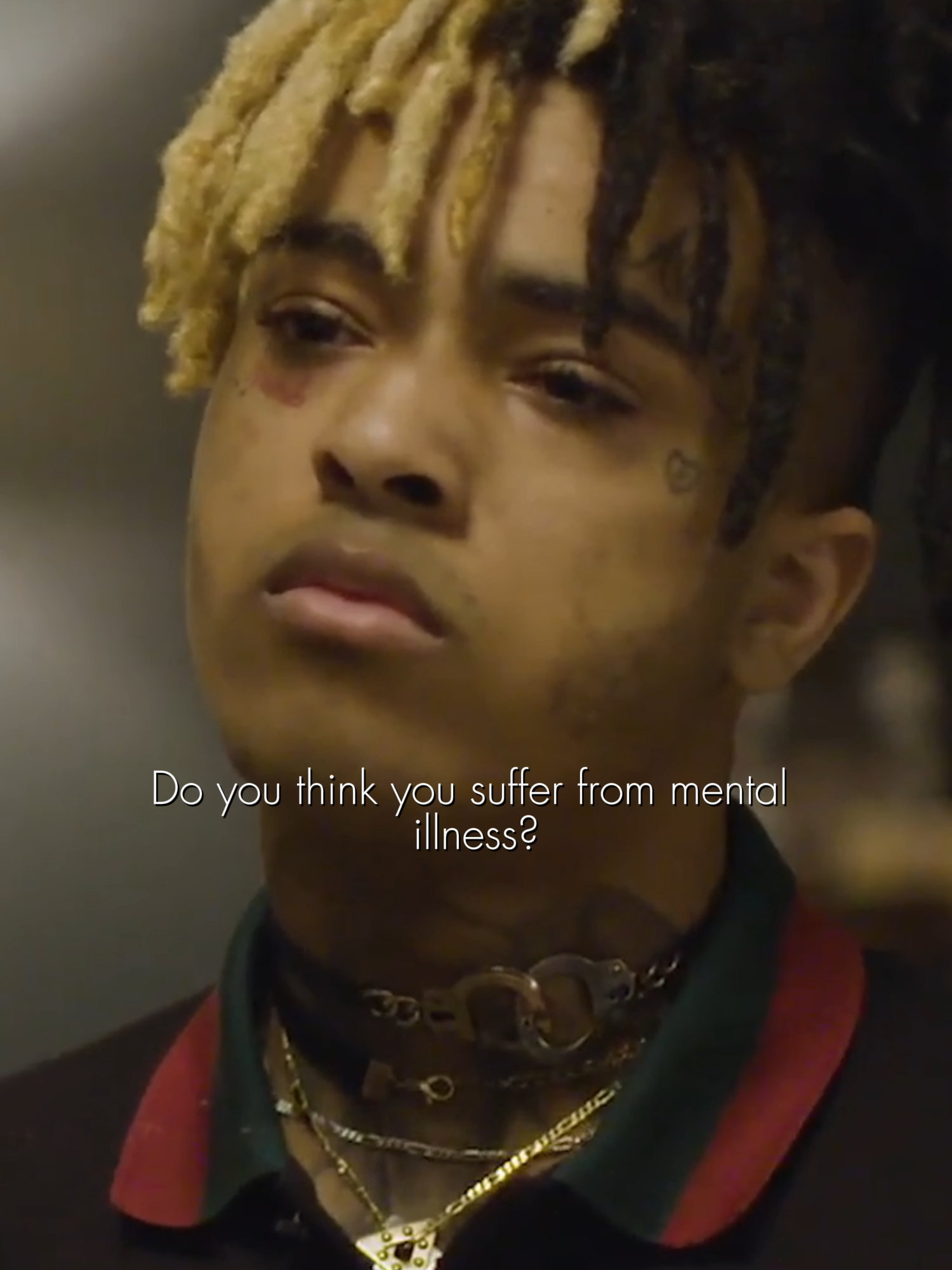 XXXTentacion, born Jahseh Onfroy, spoke openly about mental illness. He didn’t hide his depression, anger, or trauma. His music was direct and personal, often based on real pain. Songs like Jocelyn Flores and Sad told stories of loss, s*icide, and emotional struggle. He didn’t try to sound perfect or hopeful. He said what he felt, even when it was dark. For many people, his honesty made them feel less alone in their own mental battles. . #goatedeagle #mentalillness #MentalHealth #xxxtentacion #rapper #real #inspiration