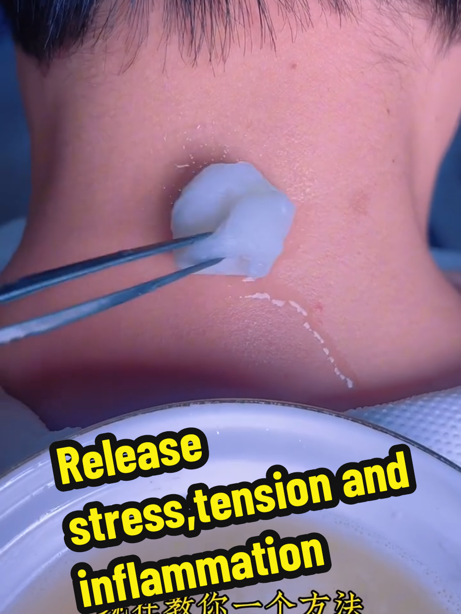 Discover the power of nature! 🌿 Watch how garlic 🧄 and radish juice 🌱 are freshly extracted and massaged onto the back of the neck to help with stiffness, tension, and inflammation. This ancient remedy is believed to boost circulation and relax muscles naturally. A must-try DIY home therapy for neck relief. #GarlicJuice #RadishJuice #NeckMassage #PainRelief #HomeRemedy #NaturalTherapy #DetoxMassage #BackNeckCare #HerbalTreatment #TikTokWellness #ViralRemedy #MassageTips #HolisticHealing #AncientCure #BodyRelaxation #DIYMassage #NeckPainRelief #HealthyLifestyle #SelfCareRoutine #TikTokHealth