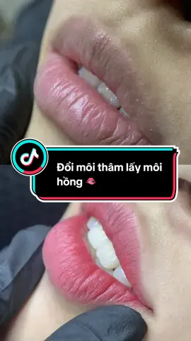 Đổi môi thâm lấy mô hồng khồng các nàng ơi 🥰 #fyp #foryou #xuhuong #phunmoitunhien #khuthammoi 