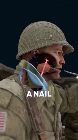 How a soldier swallowed a nail 🔨