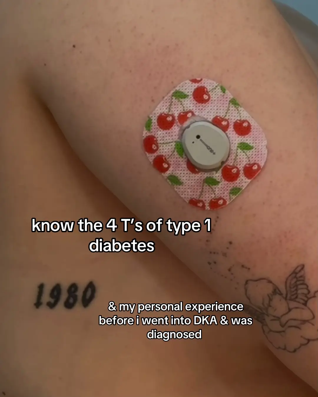 #diabetes #diabetic #typeonediabetes #typeonediabetic #type1diabetes #type1diabetic #typeonediabetesawareness #diabetesawareness 