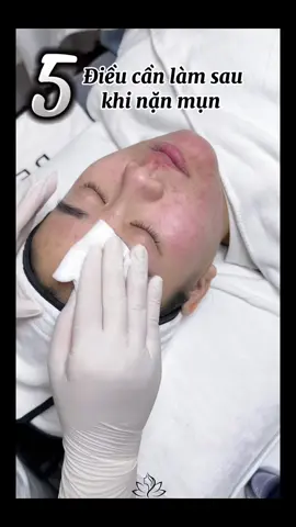 Huyn Beauty gửi bạn 5 điều cần làm sau khi nặn mụn nha  #dieutrimun #nanmun #xuhuong #viral #nanmunchuanykhoa #chamsocda #CapCut 
