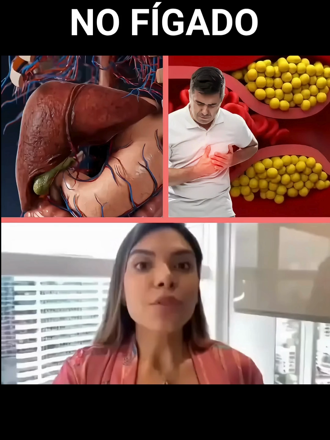 🥵 Gordura no Fígado? 💊 Suplemento 100% Natural 💬 Me chama no WhatsApp! #gorduranofigado #gorduraabdominal #cirrosehepatica #cirrose #saudedofigado #figdetox