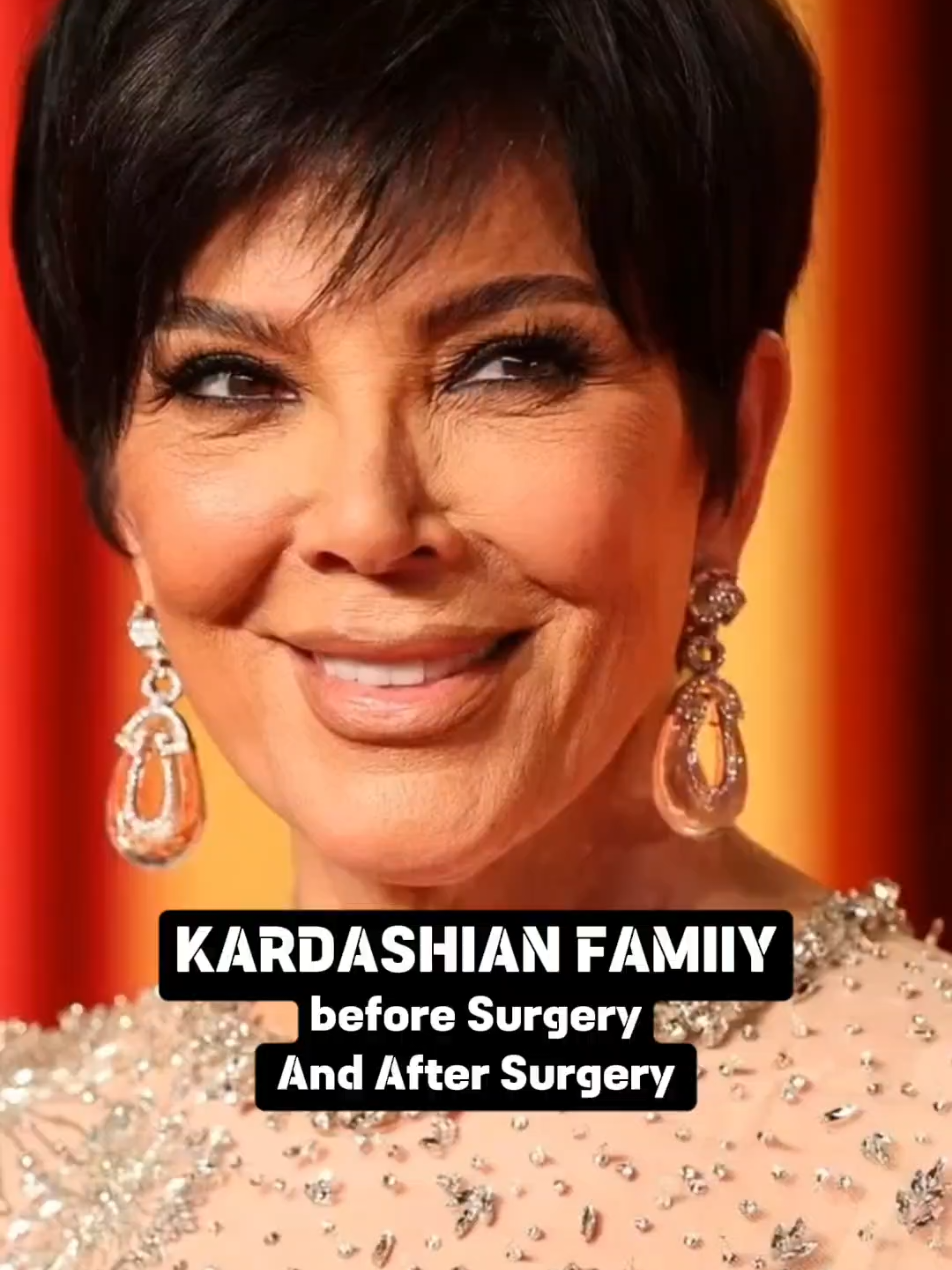 kardashian Family before Surgery And After Surgery  😳 #kardashians #surgery #evolution #throughtheyears #foruyou #viral_video #celebrity #entertainment #hollywood #thenvsnow #yourthereason #usa #keilyjenner #kandeljenner #france🇫🇷 #usa 