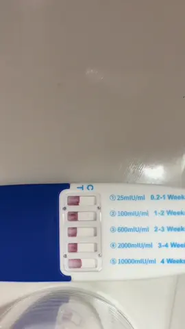 Sono molto spaventata sto sanguinando leggeremente da una settimana ma i test sembrano ancora buoni, domani dovrei essere a 7 settimane e ho la prima ecografia. C’è qualcuna che ha avuto sangue durante le 6/7 settimane? Ho così tanta paura…#ttc #ttcjourney #ovulation #momtok #foryou #fyp #fy #pregnancy #pregnant #tryingforababyg #positivetest #bbt #lineprogression #blood #7weeks 