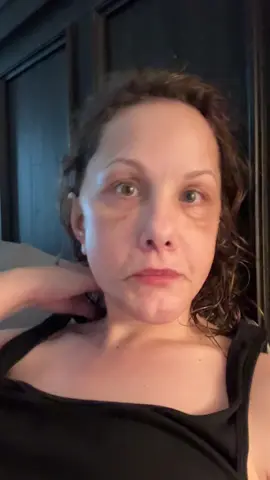 #over50tiktok #facelift #over50women #faceliftjourney #medicaltourismmexico #deepplanefacelift #necklift @Dra Maribel Belmontes 