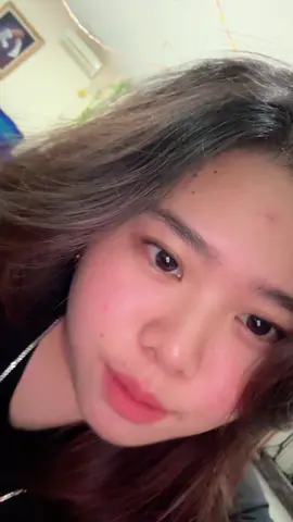 paling emosi ada orang ngomong  🔊IH JERAWAT NYA GEDE BGT 🔊 lagi otw dapet woi elahhhh 🙂🙏🏻🙂🙏🏻🙂🙏🏻🙂 #fypdong #fyp #fyppppppppppppppppppppppp #jerawat #comemypage #mylife 