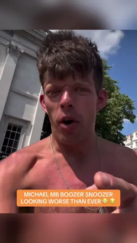 Michael MB boozersnoozer looking worse than ever 😳🫩 #hstikkytokky #hstikkytokkyclips #mb #hstikkytokkylive #fyp