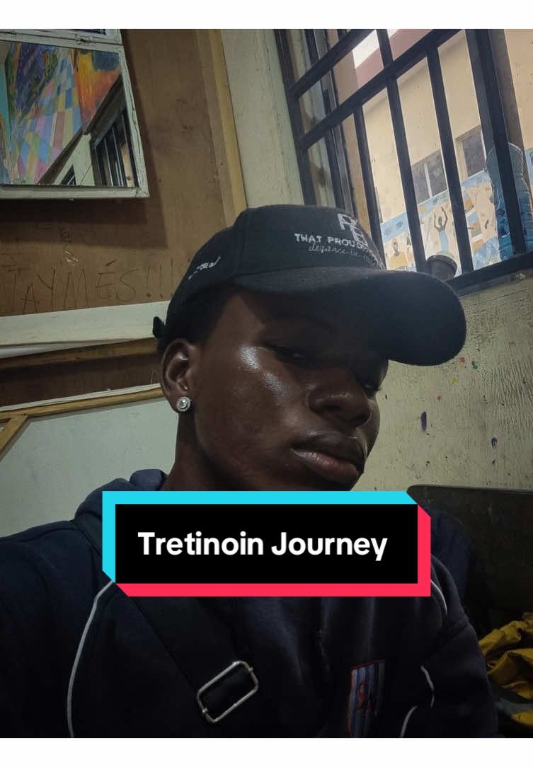 My Tretinoin journey #ugccreator #ugccreator #ugccommunity  #tretinoin, #skincare, #acne, #oilyskin #skincareroutine, #menskincare #tretinoinjourney