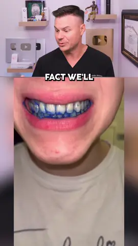 Dentist Reveals Teeth Whitening TRUTH! 😮🦷 #teeth #whitening #dentist 
