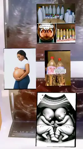 Tomber enceinte rapidement dans un mois  #fécondité #enceinte #grossesse #fertilité #camerountiktok🇨🇲 #maroc #cotedivoire🇨🇮225 #senegalaise_tik_tok #mali #guinéenne_fière🇬🇳🇬🇳 #canada_life🇨🇦 #togotiktok228🇹🇬 #france #bukinafaso🇧🇫🇧🇫 #congo #marocaine🇲🇦 #guinéenne_fière🇬🇳🇬🇳🇬🇳tiktokguinee224🇬🇳 #vue #vues #enceinte🤰😍 