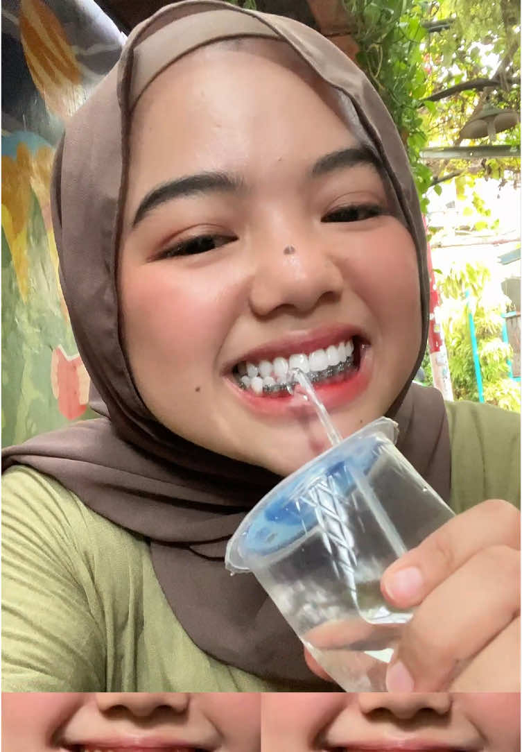 Anda tidak bisa semua menyikat gigi salah#gigi#pastagiginuskin #pastagigipemutih #pastagigianak #karanggigi #pastagigialami #perawatangigi #pastagigiap#sakitgigi #murah #pemutihgigimurah #pasta #pastagigiaman #sikatgigi #gigiberlubang #jualap #gigibersih #herbal #nuskinap #like #OralCyberX#DiskonAkhirBulan 