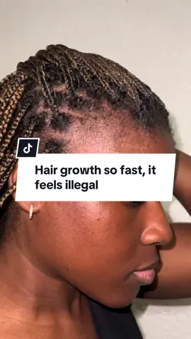 Comment ‘growth’ for the exact routine + products used! #hairgrowthproducts #hairgrowthjourney #edgesgrowingback #edgesregrowthoil 