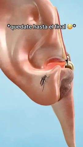 No puedo creer que tenía esto en el hueco!! 😱 limpieza de oídos, cerilla, salud, cosa satisfactoria, no se que pensar, TikTok me hizo comprarlo, limpieza extrema, descubrimiento loco, viral, envío gratuito, oferta limitada, TikTok Shop, producto útil, compras TikTok