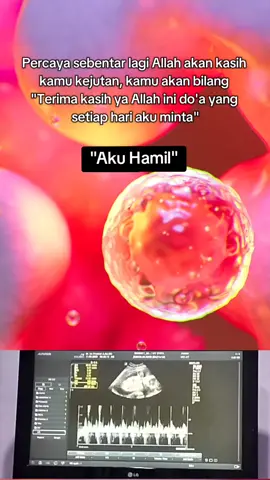 Masyaallah tabarakallah allahumma aamiin  Afirmasi diri selalu 🤲.. #afirmasipositif #pejuanggarisdua #hamil #positifhamil #promil #programhamil #pregnancy 