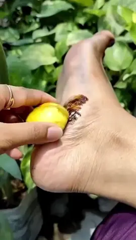 Hand & Feet whitening scrub at home#skincare #scrubs #GlowUp #bleach #skincaretips #homeremedy #handwhitening #viralvideos #handwhitening #growmyaccount #plzzz_saport_me #100kviews #plzviral🥺🥺🙏🙏foryoupage #goviral #foruyou 