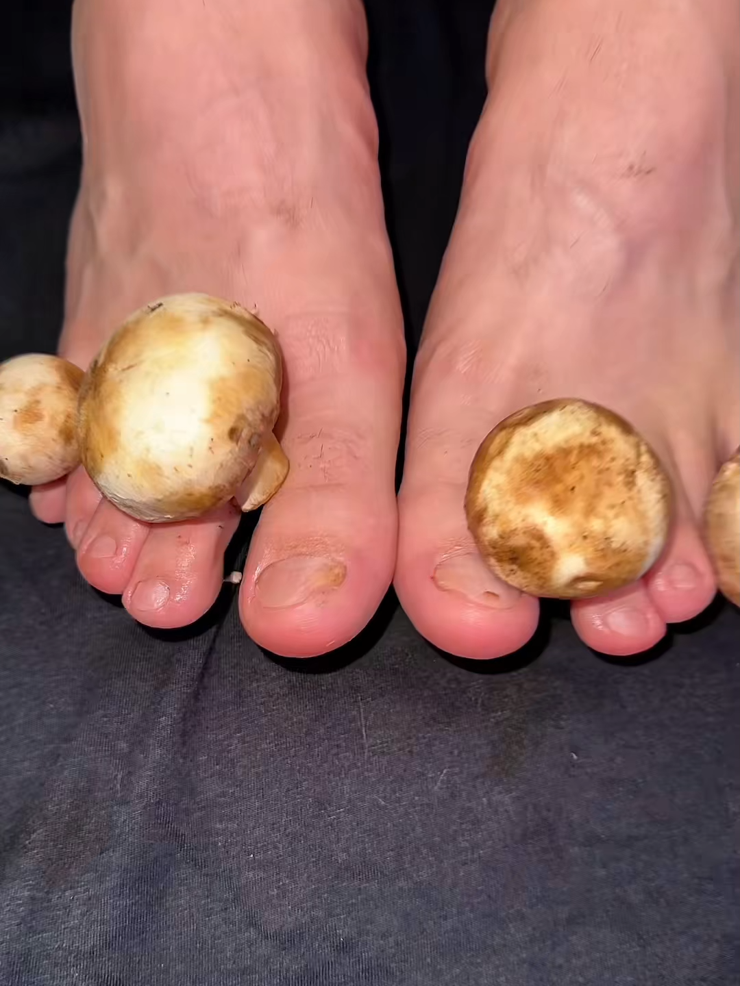 UV Genocide! Exposing Fungal Graveyards ⚰️ Microbial Holocaust#AIFungusDetector #StrainSequencing #DeathRay #QuantumImaging#nailtools #DIYnails #callus