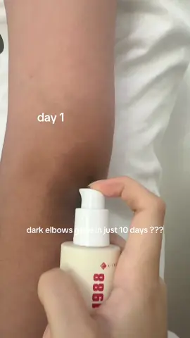 dark elbows GONE  Product name: KSECRET - SEOUL 1988 Serum: Retinal Liposome 2% + Black Ginseng You can buy this on Yesstyle and use code: EB898989 for extra discount   #darkelbows #darkelbowsolution #darkknees #brighteningskincare #whiteningskincare #retinal #retinalcream #retinalskincare    #glowupwithretinalchallenge  #bestkoreanskincare #trendingkoreanskincare #viralkoreanskincare #viralskincareproducts #trendingskincareproducts   #koreanskincare #ksecret  #darkspotserum #whiteningserum 