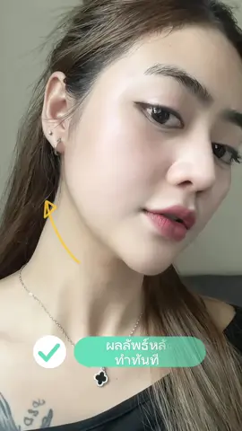 บอกคำเดียวต้องทำ ทำเท่านั้น มันดีเว่อ  @BYB (บีวายบี) Clinic #bybclinic #hifu #ความงาม 
