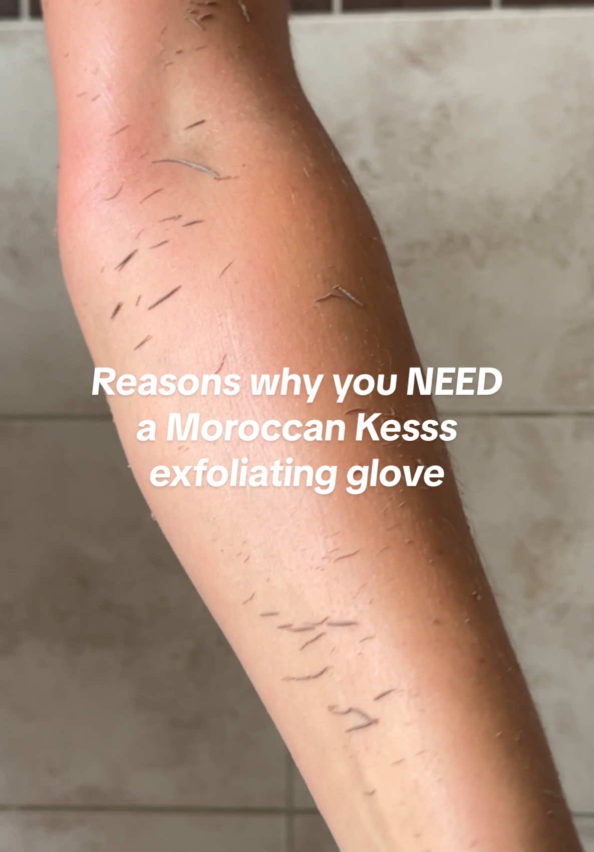 There are too many benefits to using a Moroccan Kessa exfoliating glove, every household should own one! #exfoliate #exfoliatingglove #summerskincare #moroccanskincare #bodycare #strawberrylegs #strawberryskin #dullskin #arganoil #ingrownhair 