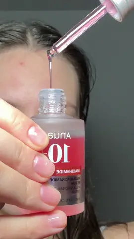 Hyperpigmentation? Problem solved 🤌🏻 Before/After 7 days of using @anua_global Niacinamide TXA serum 🧚🏻✨  Results: • reduced color and mostly healed problematic area, I will continue using it till it’s gone tho • skin tone more even & small closed comedons are gone 🌸 Love that it has no smell and is very light on the skin, so even tho my skin is pretty dry, it didn’t cause any irritation, loved it and def added to my list of favorites #anua #ulta #sephora  #anuaskincareroutine #beforeandafterskincare #Skincarebeforeandafter #koreanskincareroutine #7daysskinreset #anuatxaserum #skincareinaweek #inaweekskincare #hyperpigmentation #glassskin #serumforglassskin #koreanskincareforglassskin #glowskin #dewyskin #skintransformation #anuaskintransformation #collaboration  #ugccontentcreator  