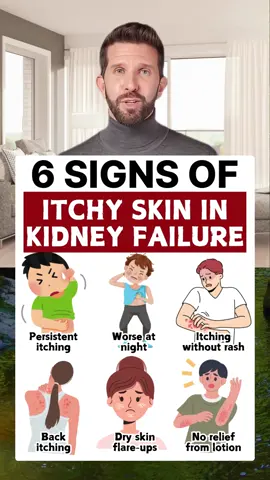 6 signs of itchy skin in kidnay failure #healthy #healthcare #healthtips #kidney #kidneydisease #kidneyfailure #itchy 