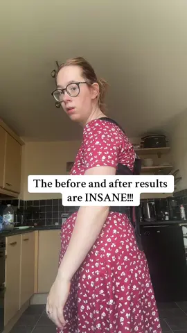 This is such a game changer!! #backstraightner #poorposture #posture #posturehack #badposture #posturecontrol #summersale #tiktokmademebuyit  