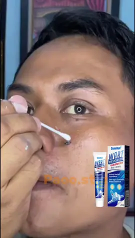 La crema que ya ayudó a cientos a quitarse esas molestas verrugas en días 👌🏻 ¡Aprovecha la promoción!  #adiosverrugas #solucion #casa #piel #antesydespues #productoquefunciona 