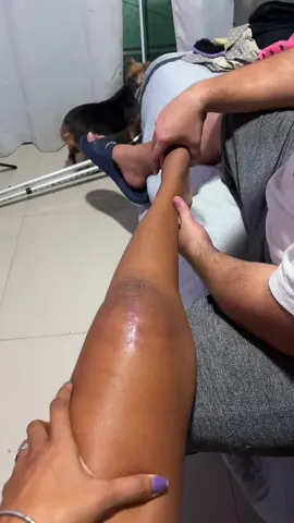Mesmo com frio hoje não teve tempo ruim pra fisioterapia  #fisioterapia #joelho #recuperacaocirurgica #fyy #patela #fratura #cicatrices #muleta #pontoscirurgicos 