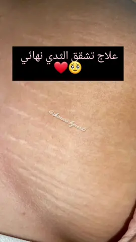 #عناية #skincare 