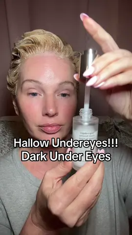 #ad if you have hollow under eyes or areas that have lost fullness I really recommend trying this out! #hollowundereyes #darkcircles #undereyecircles #undereyes #tiktokshopcreatorpicks 