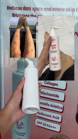 Ma-Peklat ka rin ba? #peklat #scar #scars #pampakinis #fyp #fypシ #taiwan🇹🇼 #ofwtaiwan 