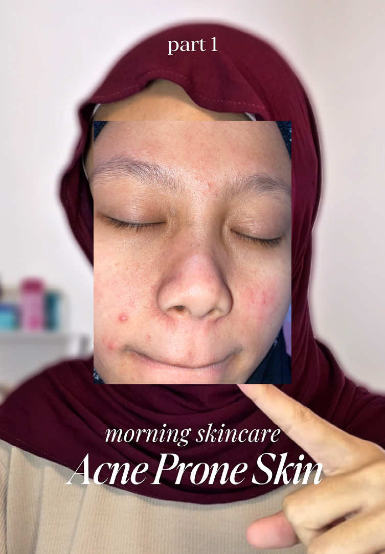 part 1, skincare acne prone skin kalau lg ada jerawat ON #acneprone #acneproneskincare 